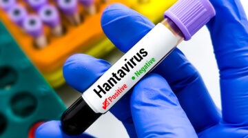 Hantavirus Cases Linked to Expedition Cruise Draw Global Attention